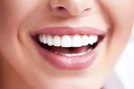 Invisalign treatment result at OrthoDental