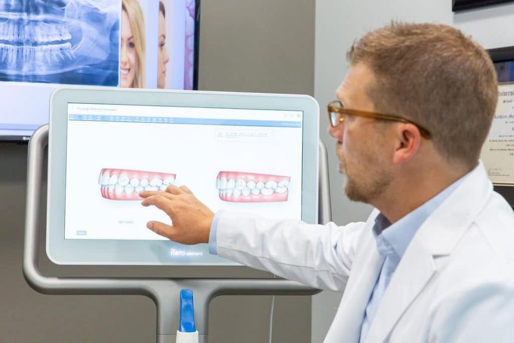 Illustration of Invisalign aligners gradually moving teeth into alignment