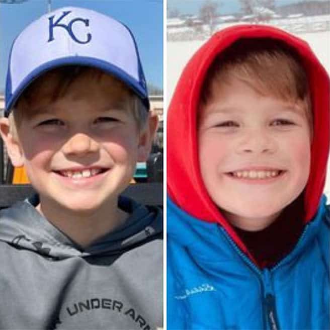 Invisalign for children