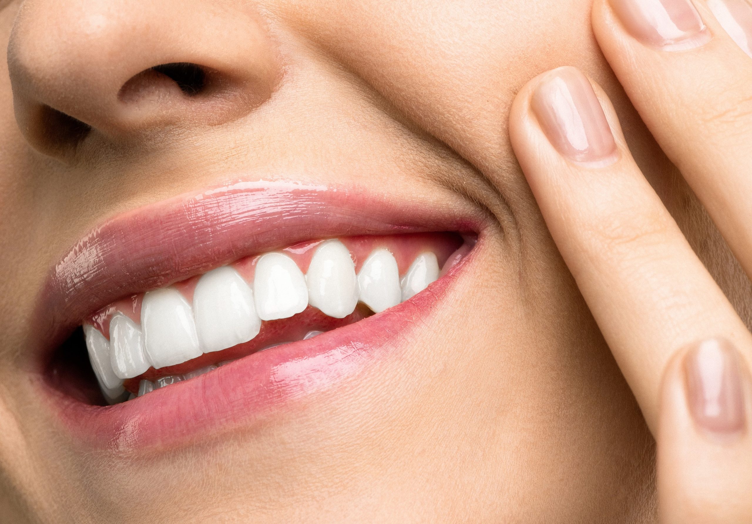 White smile after teeth whitening procedure
