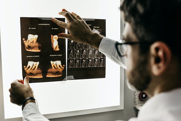 Dentist looking at X-ray of patient's teeth