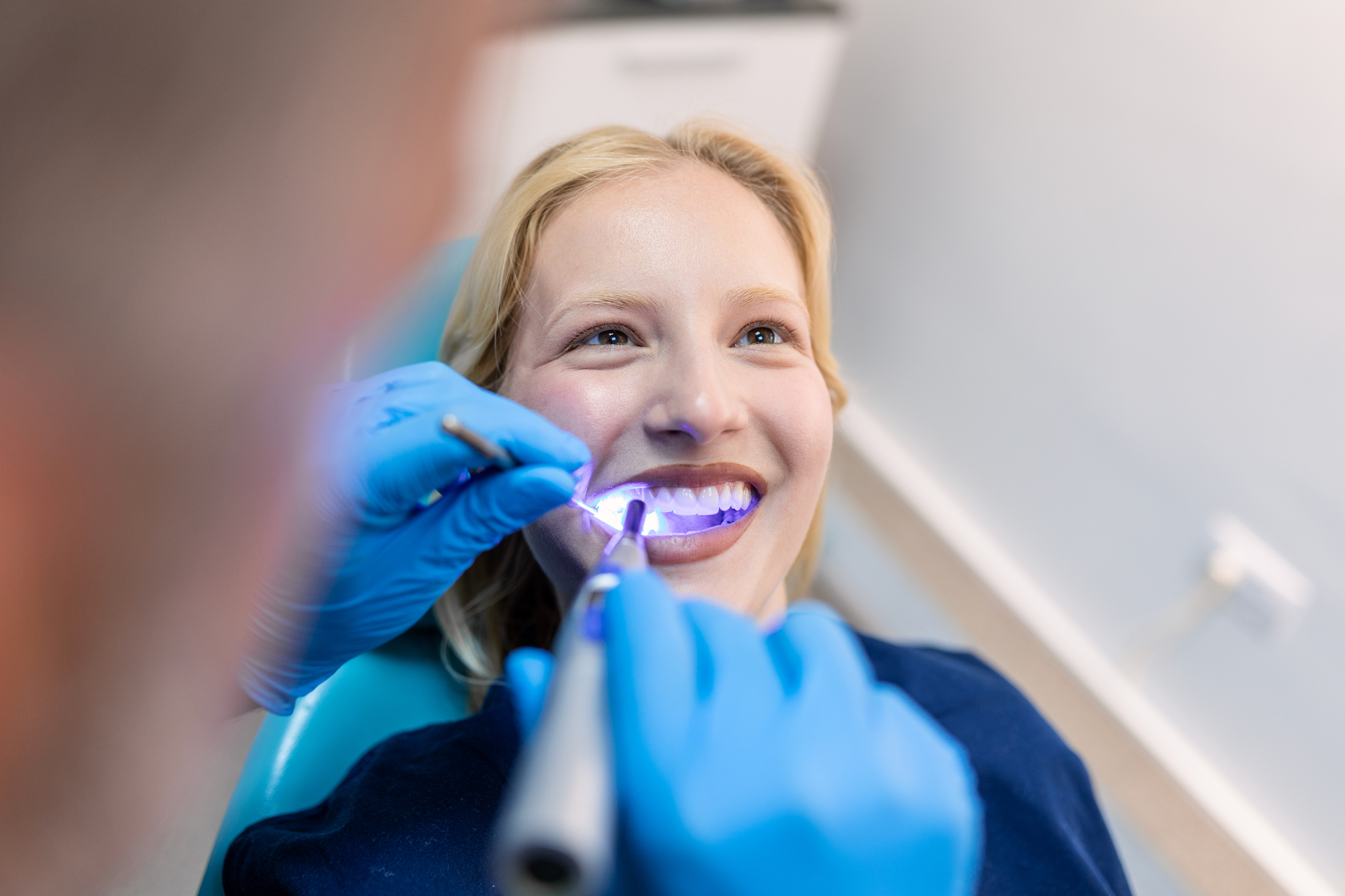 Tooth bonding
