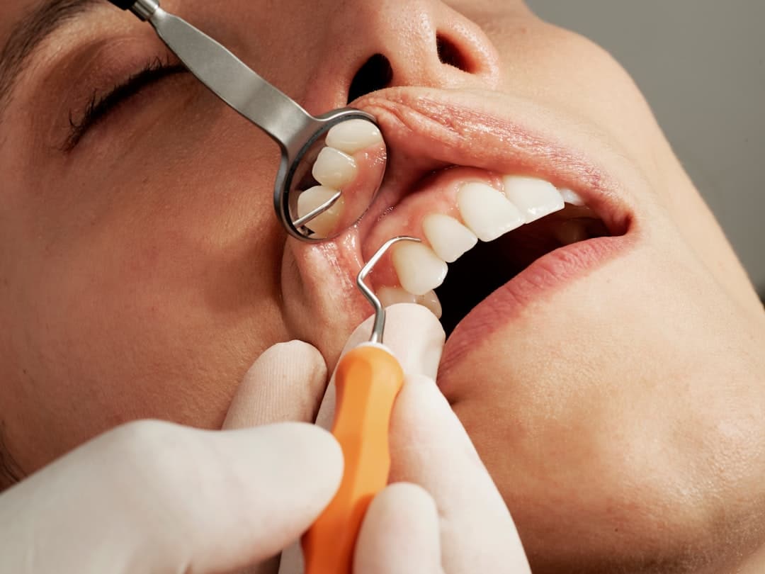 Dentist examining a patient’s tooth with a mirror during a root canal assessment
