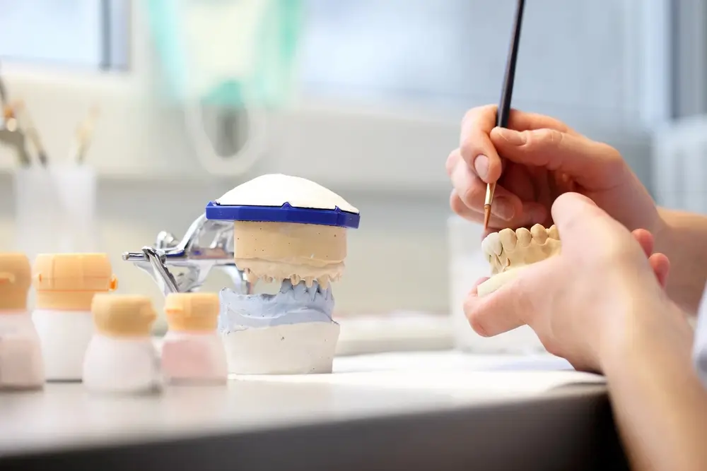 Dental technician precisely fabricating a metal-acrylic partial denture in a dental laboratory