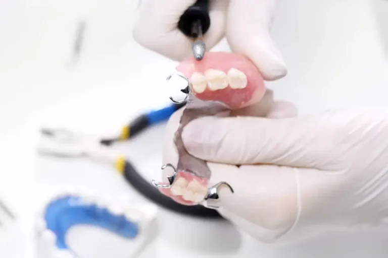 Dental technician refining ceramic teeth on a plaster model in a dental laboratory
