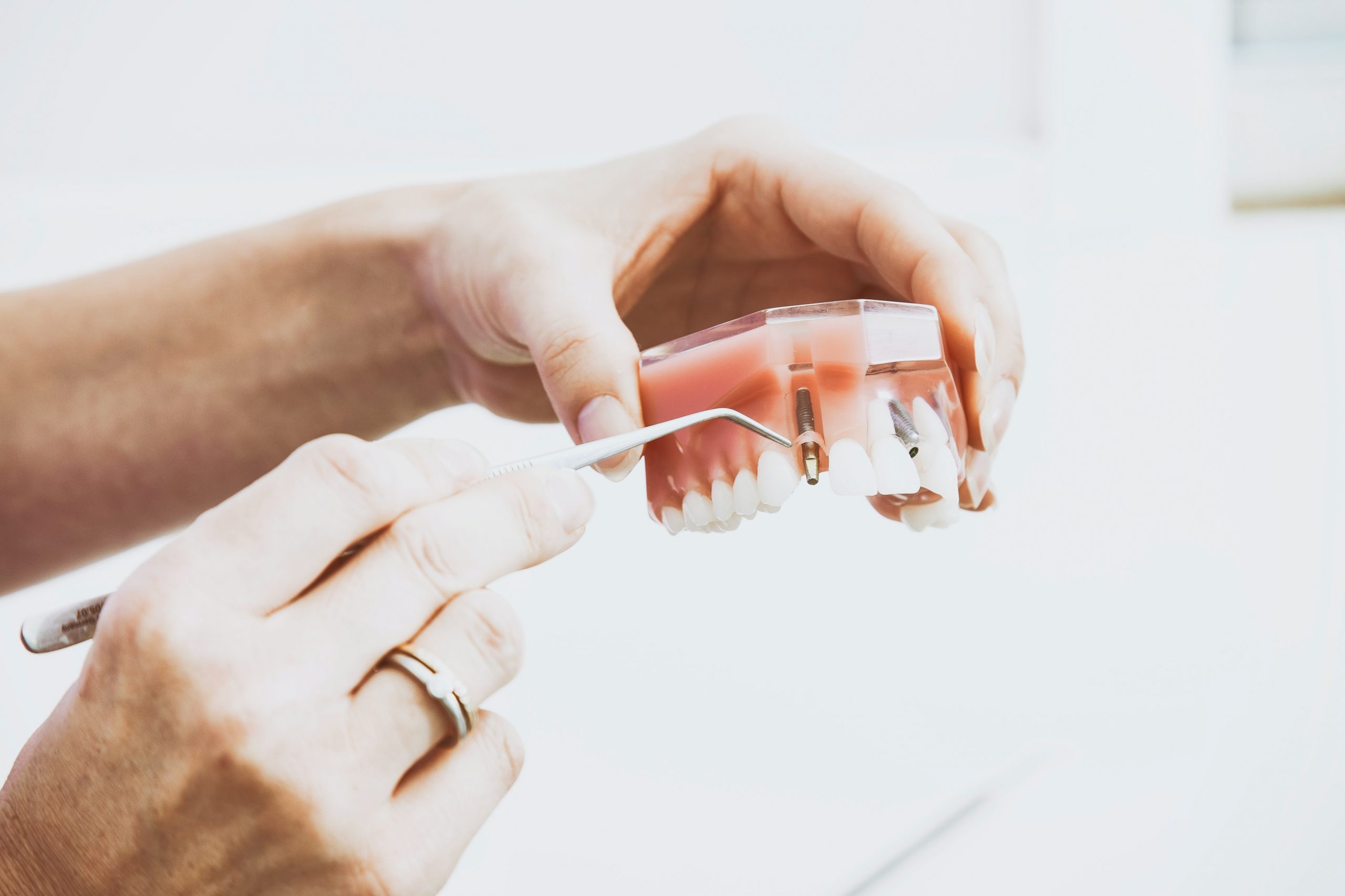 Zobozdravnik pri OrthoDentalu pregleduje 3D CBCT rentgenski posnetek čeljusti pred vstavitvijo zobnega implantata.