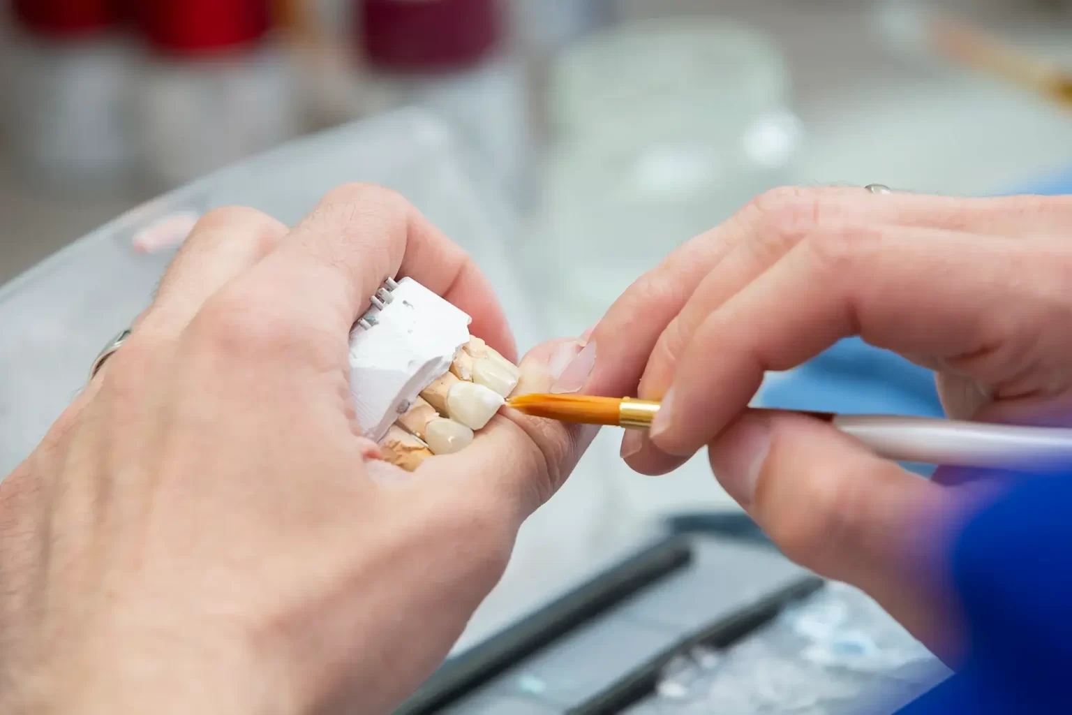 Izdelava zobne prevleke v zobnem laboratoriju