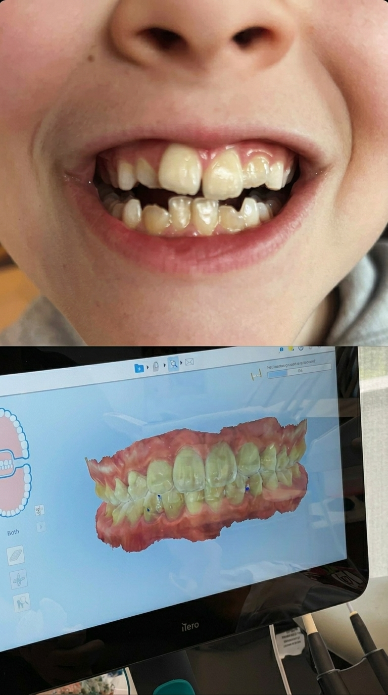Otroška ortodontija z digitalnim 3D skenom za preverjanje ugriza, rasti čeljusti in prostora za stalne zobe.